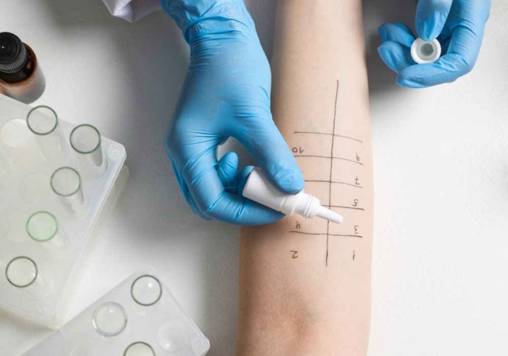 Somministrazione di Test Allergologico | MED Cremona